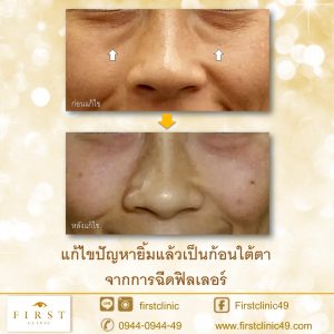 แก้ไข-2