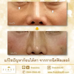 แก้ไข-3a